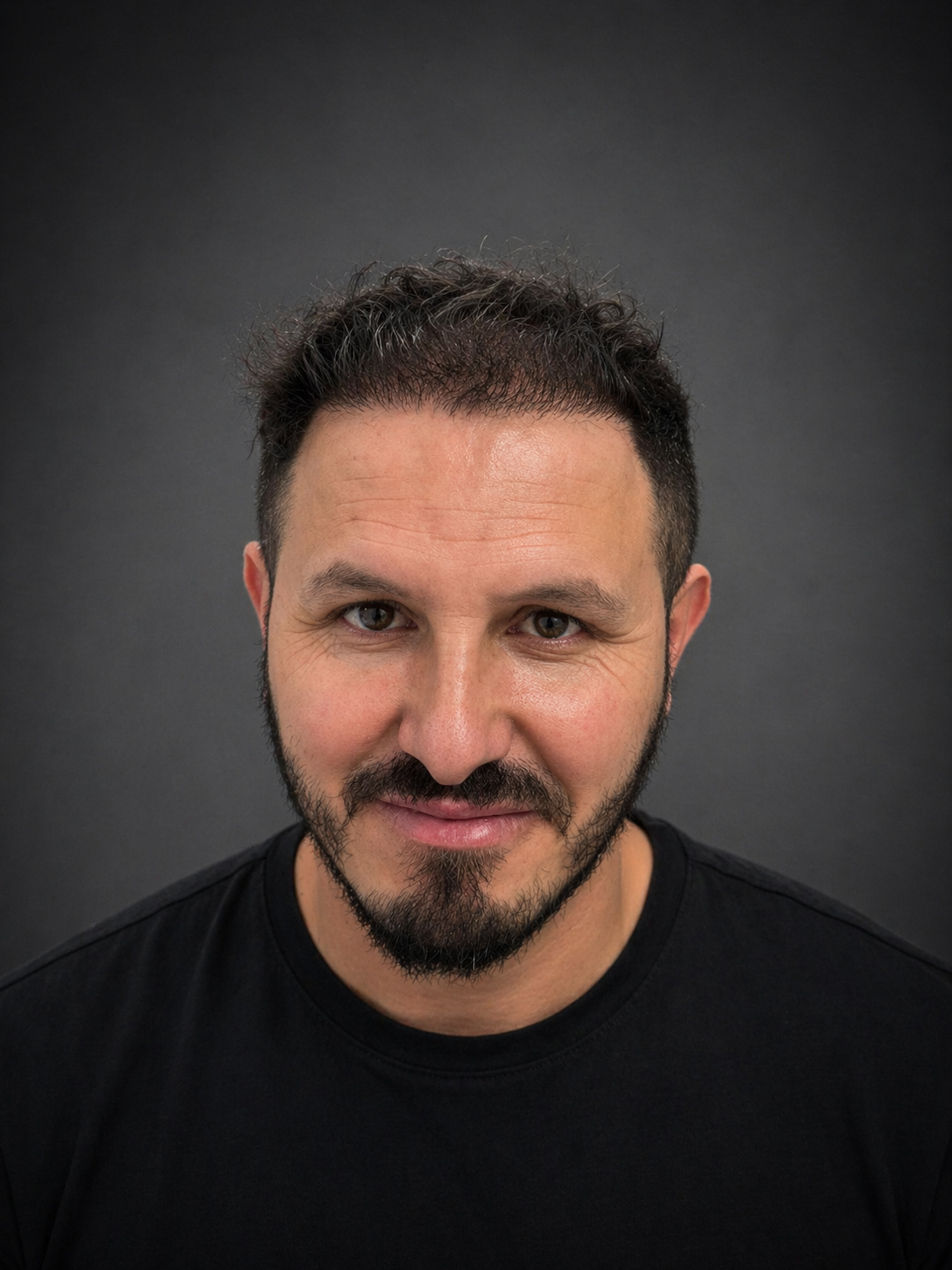 After the hair transplant procedure