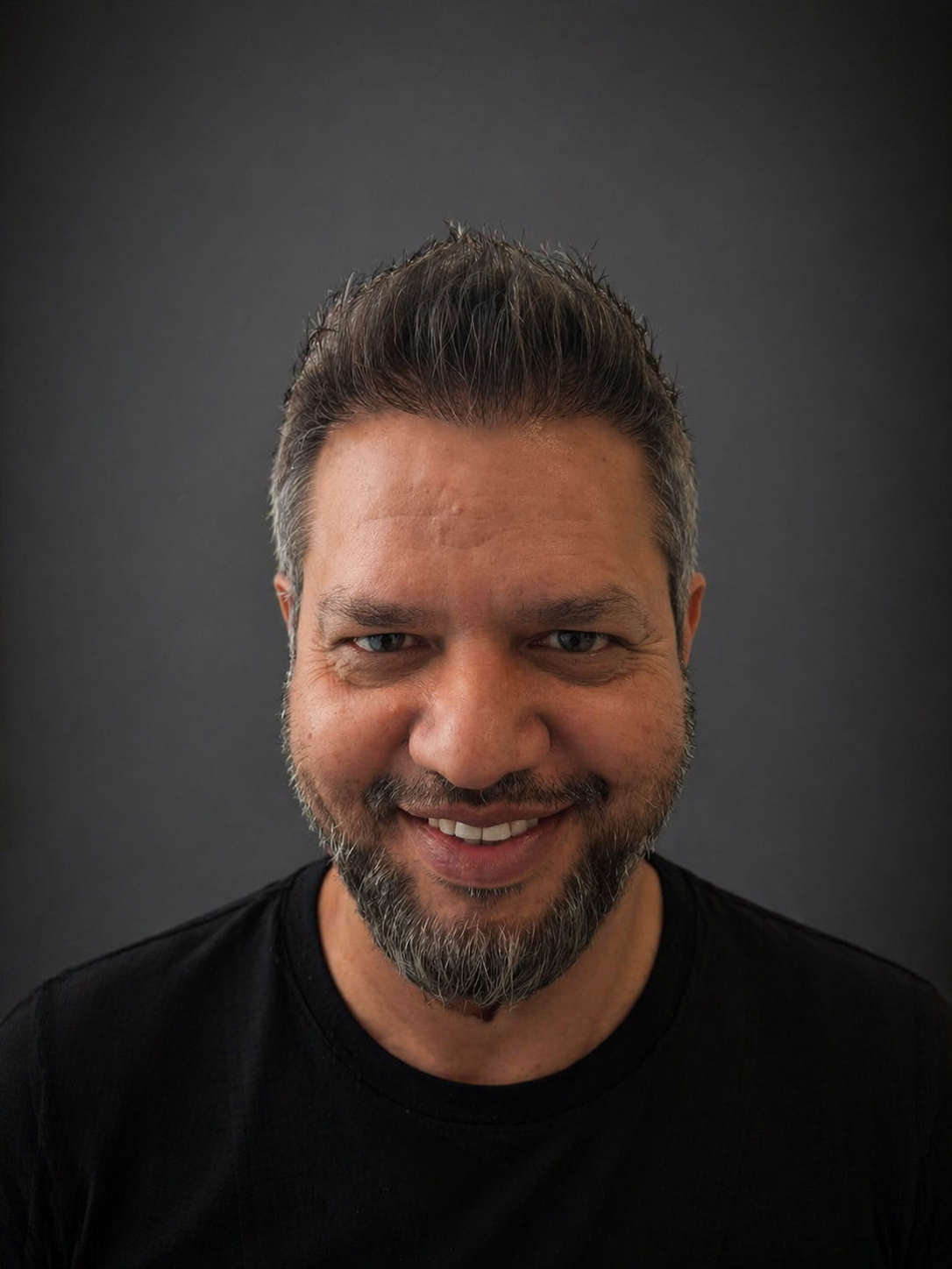 After the hair transplant procedure